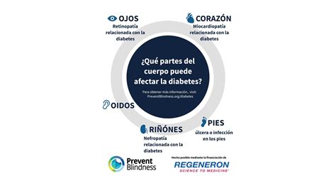 As Part of November's Diabetes-related Eye Disease Month, Prevent ...