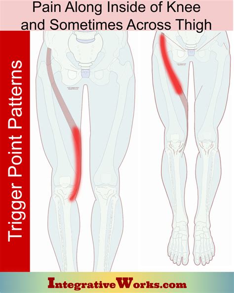 Burning Sensation In Thigh