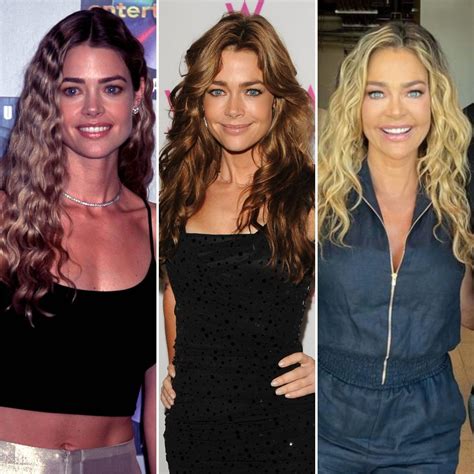 Denise Richards Face Plastic Surgery