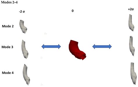 Machine Learning and Statistical Shape Modelling Methodologies to ...