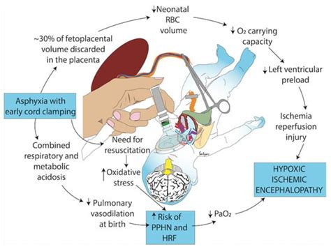 Making the Argument for Intact Cord Resuscitation: A Case Report and ...