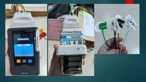 Image result for Telemetry Monitoring Basics