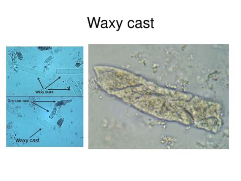 PPT - Urine analysis PowerPoint Presentation, free download - ID:8706530