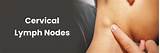 Todo sobre los ganglios linfáticos cervicales: guía esencial