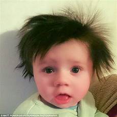Baby Hair That Sticks Up by Baby Is Nicknamed Harry Styles After He S Born With A Baby Hair That Sticks Up