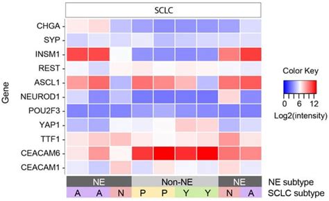 ATOH1, TFAP2B, and CEACAM6 as Immunohistochemical Markers to ...