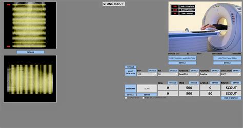 Image result for CT Cystogram vs Urogram