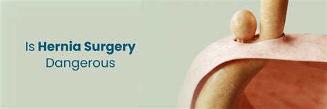 Is Hernia Surgery Dangerous? Risks, Recovery & Facts