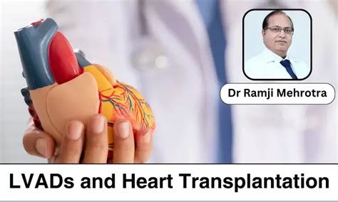 Advanced Therapies for Heart Failure: A Comprehensive Look at LVADs and ...