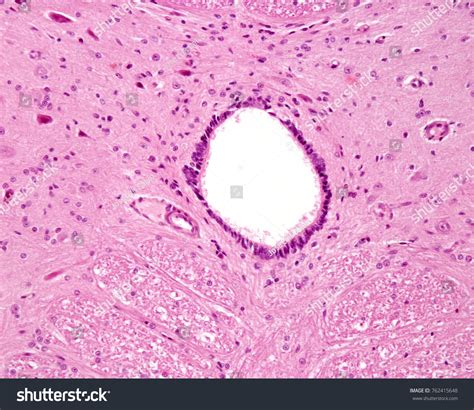 Ependymal Cells Histology