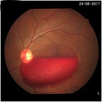 Department of Ophthalmology - Chettinad Academy