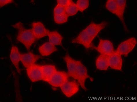S100A4 antibody (CL594-66489) | Proteintech