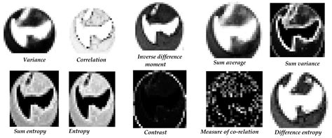 Healthcare Professional in the Loop (HPIL): Classification of Standard ...