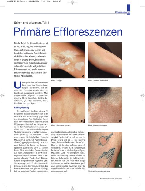 Bildergebnis für effloreszenz