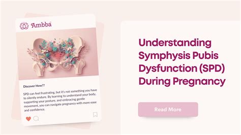 Understanding Symphysis Pubis Dysfunction (SPD) During Pregnancy - Ambba™