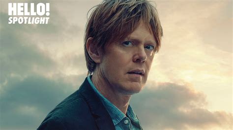 Kris Marshall Face Surgery