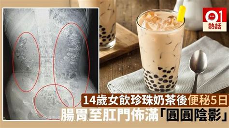珍珠奶茶里的“Q弹的珍珠”是什么做的？粘粘的正常吗……-南通市通州区人民政府