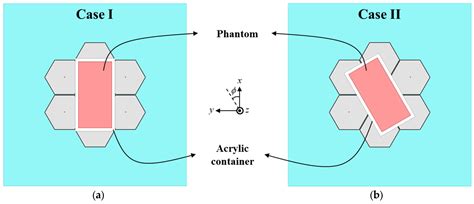 Design of Orientation-Independent Non-Invasive Glucose Sensor Based on ...