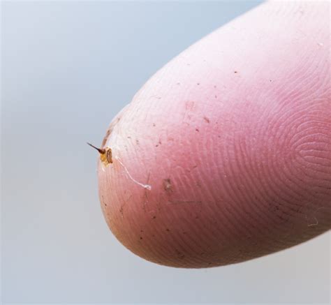 Bumble Bee Sting Bumble Bees Can Sting Twice. Summer Tips | By