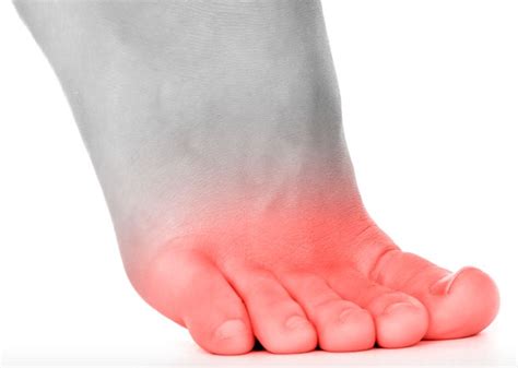 Foot Pain Diagnosis Chart Uk - Reviews Of Chart