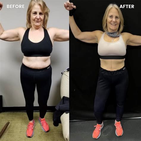 Belly Fat Before And After