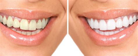 Mig Dental Clinic