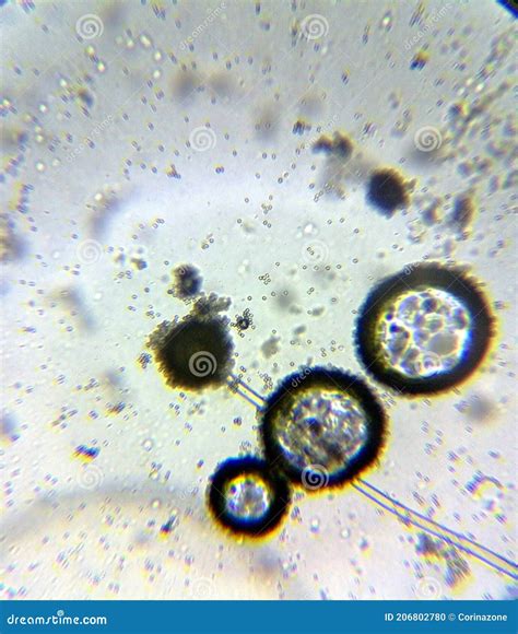 Aspergillus Niger the Black Mold Conidia Under the Microscope Stock ...