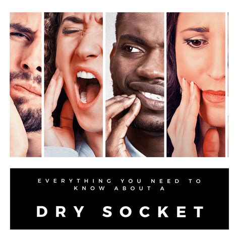 Everything You Need to Know About a Dry Socket - Romans And Soltani Dentistry