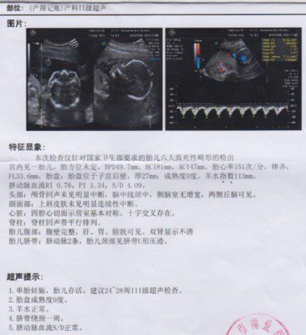 老婆现在怀孕23周3天，做四维彩超检查报告显示胎儿大小相当于24周3天 胎儿右侧侧脑室宽约1CM - 百度宝宝知道