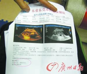 胎儿初检被指“死胎” 更换医院检查后复活(图)-搜狐新闻