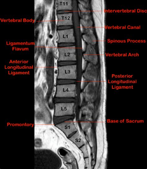 Image result for Bully Algorithm and Ring Algorithm Diagrams