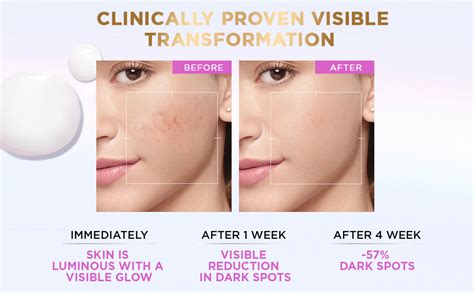 L'Oreal Paris Brightening Serum, 1% Glycolic Acid, 2% Niacinamide Serum ...