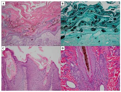 Current Topics in Dermatophyte Classification and Clinical Diagnosis | MDPI