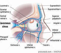 Image result for 窦 cavernous sinus