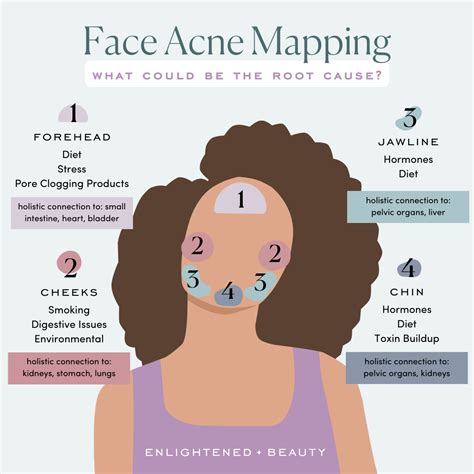 Face And Body Acne Mapping — Enlightened Beauty by Morgan Elizabeth