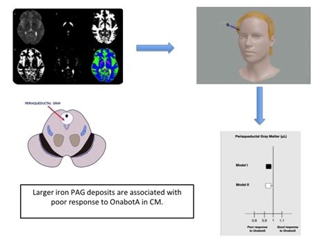 Iron Deposits in Periaqueductal Gray Matter Are Associated with Poor ...