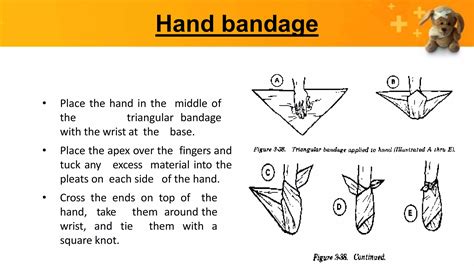 BANDAGING: TRIANGULAR BANDAGING AND CRAVAT, TYPES OF KNOTS | PPTX