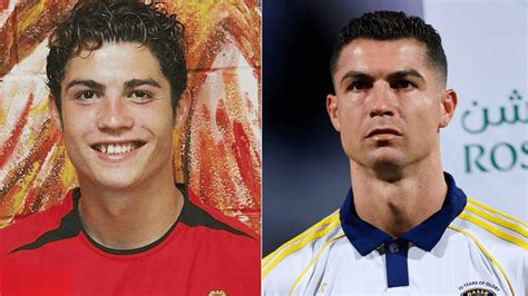 Ronaldo Before Plastic Surgery: 2003–2025 Timeline - Sporthiatus