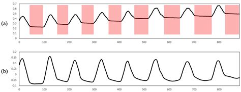 A Real-Time Remote Respiration Measurement Method with Improved Robustness Based on a CNN Model