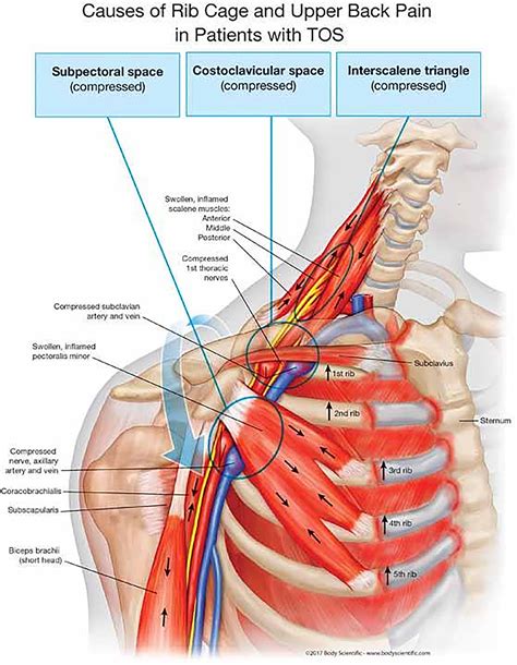 Red Man Syndrome Icd 9