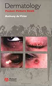 Dermatology Pocket Picture Book: 9780632054282: Medicine & Health ...