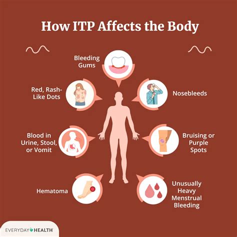 Idiopathic Thrombocytopenic Purpura Rash