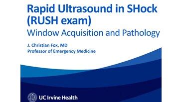 Point of Care Ultrasound Case Studies | GE Healthcare