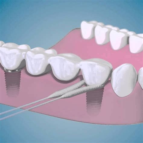 Hilo Dental Superfloss Oral-b Importado (refrescante Menta) - Bs. 500. ...