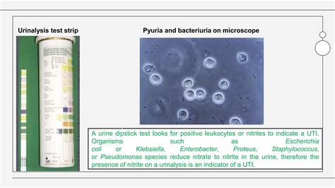 Urinary Tract Infection.pptx , cystitis , lower and upper urinary tract infection | PPTX