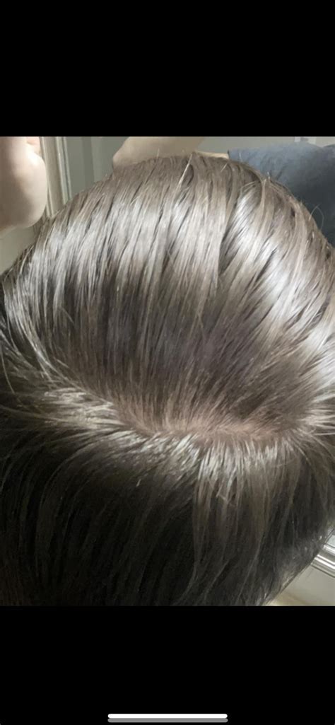 A lot of people said i’m balding from the crown but this is super ...