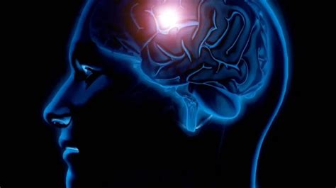 Brain stroke disease occurring young age go hospital as soon as you see ...