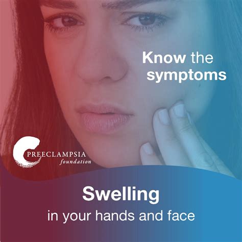 Preeclampsia Facial Swelling