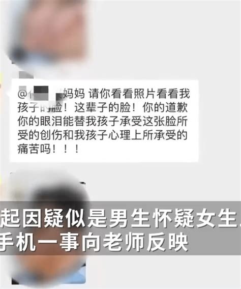 初中男生被女同学泼热水致毁容，知情人：女生怀疑男生举报她上课玩手机，校方：一直在沟通解决_家长_截图_大象