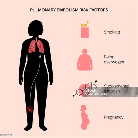 What is a pulmonary embolism, the condition that led to Catherine O’Hara’s death? | CNN